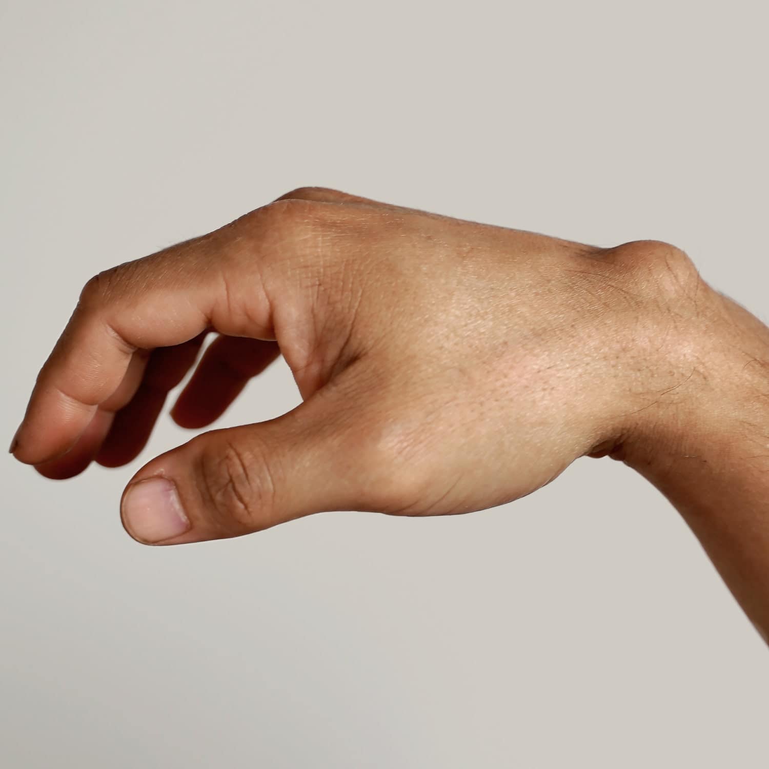 Home-Conditions-Sarcoma-1-min