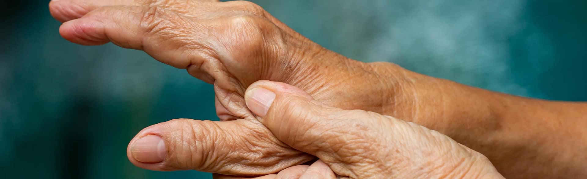 Older person with arthritis of the hand