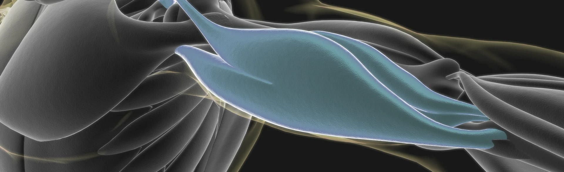 Illustration of Xray of the the upper arm to show Long Head Bicep Tear