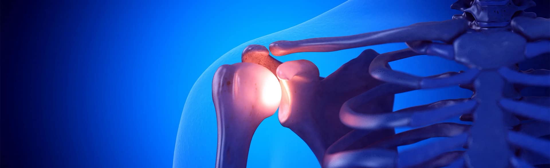 Shoulder Instability Skeletal image of shoulder to display shoulder instability