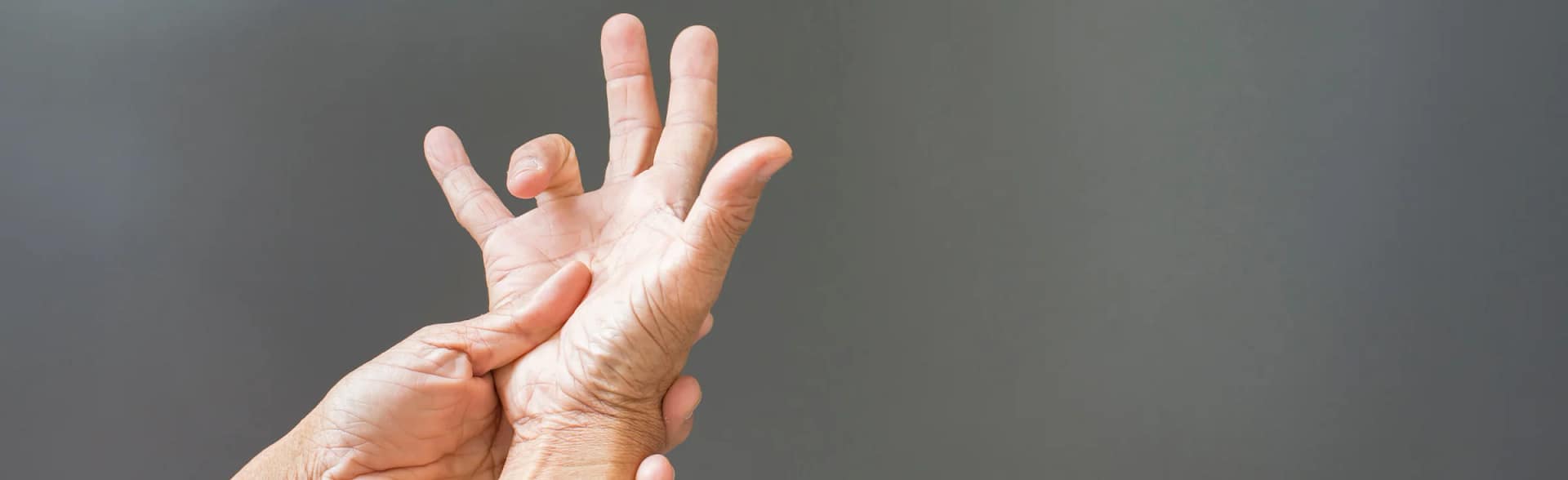 Trigger digit Hand showing person suffering with a trigger digit