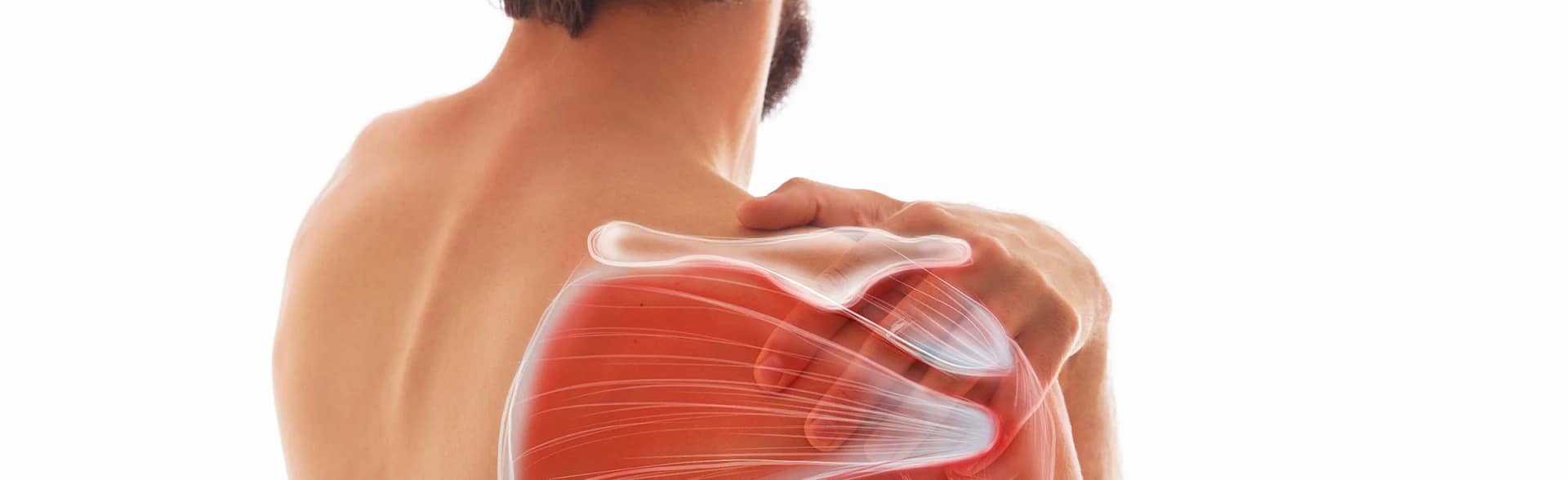 Man holding shoulder which shows muscles visible to demonstrate shoulder impingement